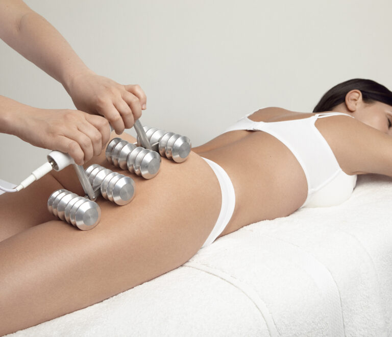 Elektrocelulitna masaža valjcima (ECM)