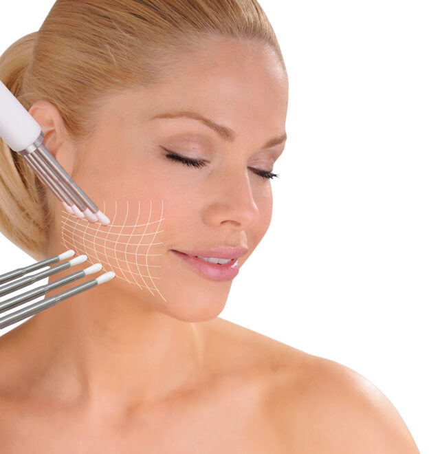 CACI Quantum – lifting lica i tijela